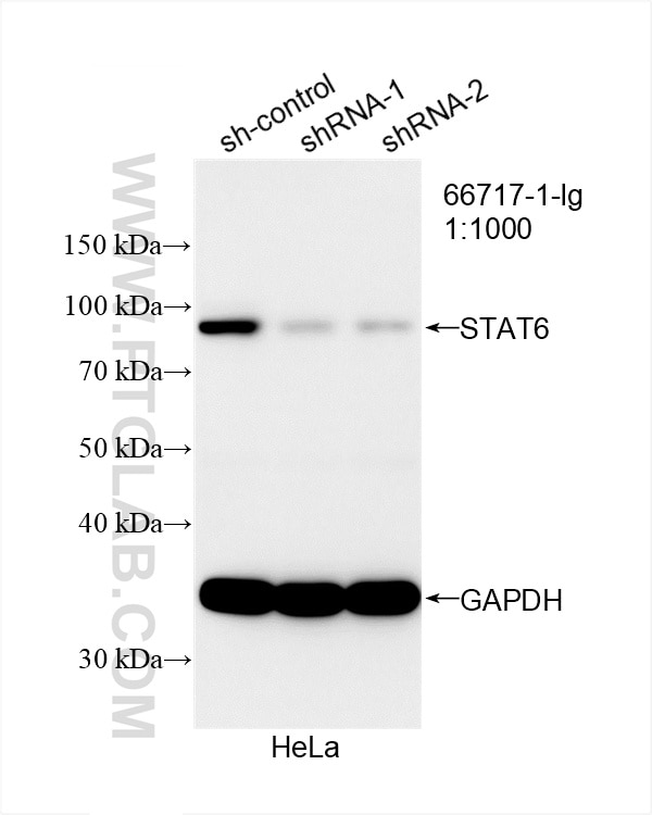 Western Blot (WB) analysis of HeLa cells using STAT6 Monoclonal antibody (66717-1-Ig)