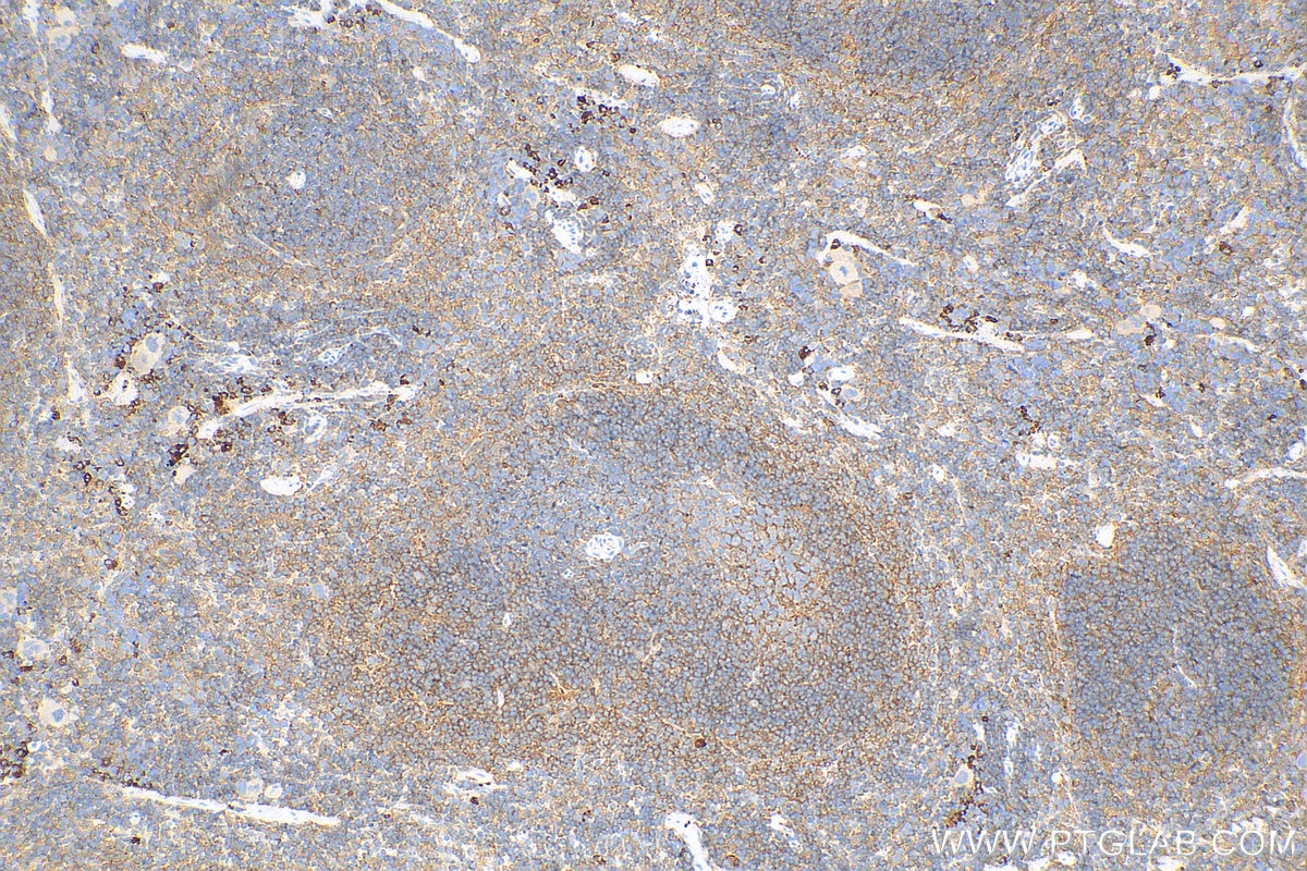 Immunohistochemistry (IHC) staining of mouse spleen tissue using STAT6 Recombinant antibody (82630-1-RR)