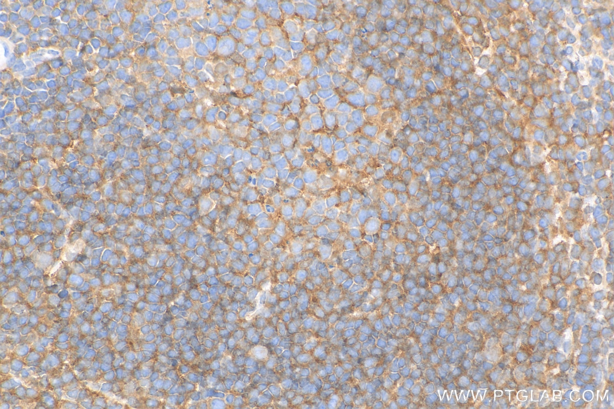 Immunohistochemistry (IHC) staining of mouse spleen tissue using STAT6 Recombinant antibody (82630-1-RR)