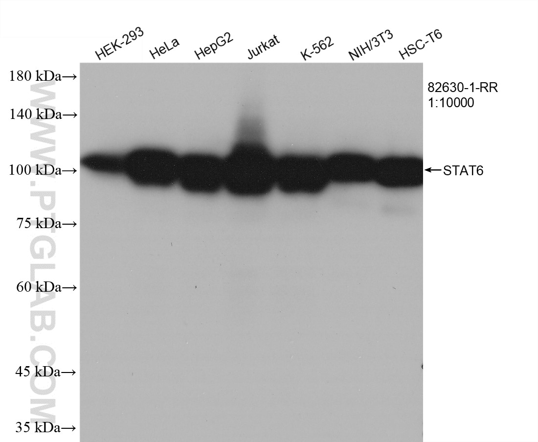 Western Blot (WB) analysis of various lysates using STAT6 Recombinant antibody (82630-1-RR)