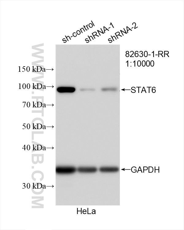 Western Blot (WB) analysis of HeLa cells using STAT6 Recombinant antibody (82630-1-RR)
