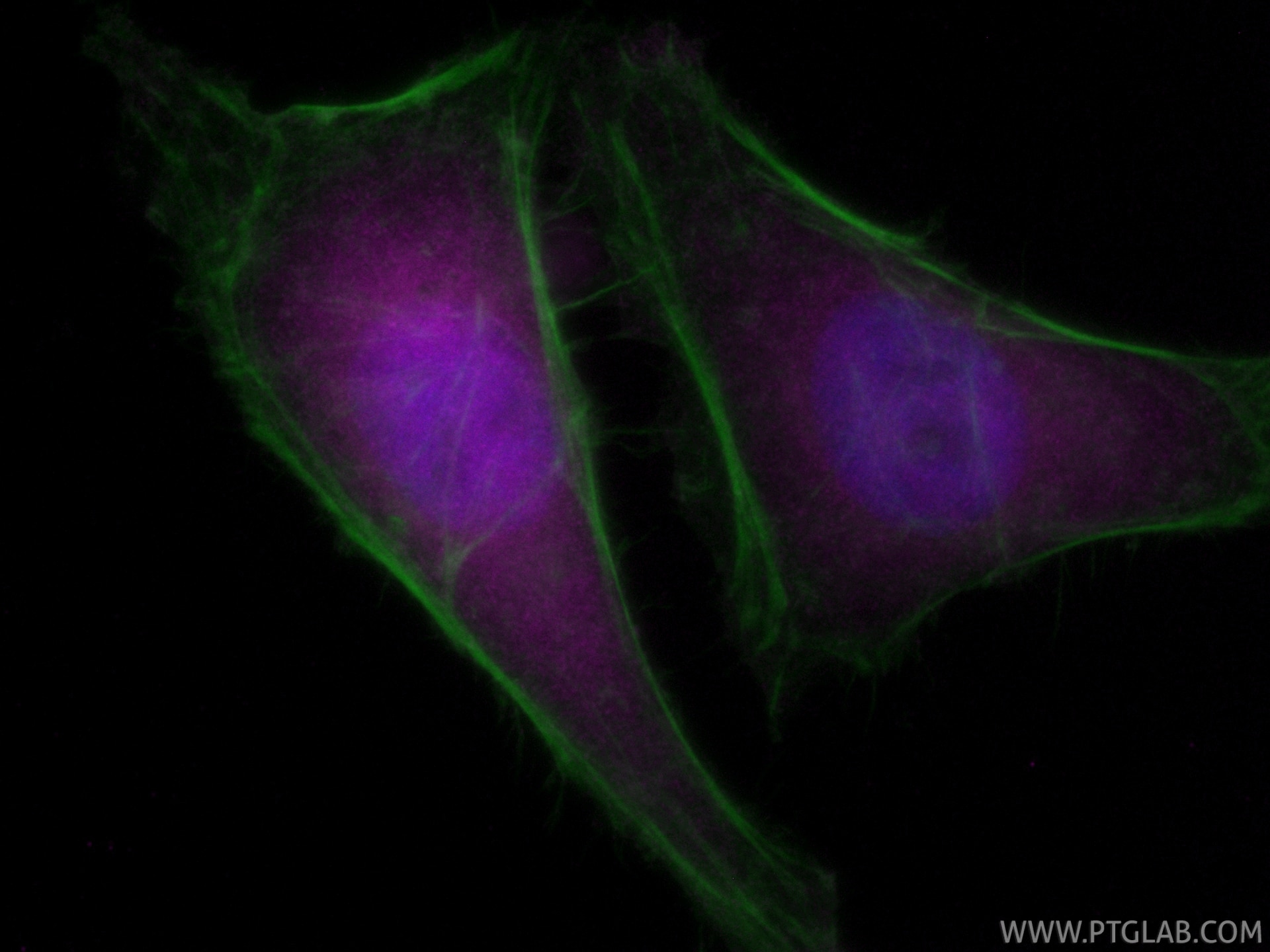 IF Staining of HeLa using CL647-82630 Immunofluorescence (IF) / fluorescent staining of HeLa cells using CoraLite® Plus 647-conjugated STAT6 Recombinant mo (CL647-82630)