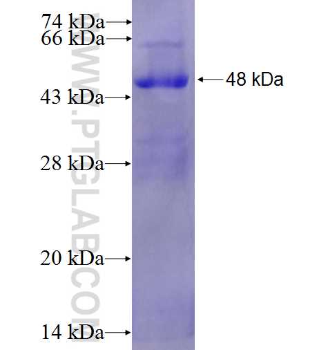 STAT6 fusion protein Ag0410 SDS-PAGE