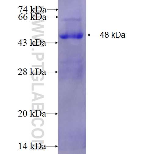 STAT6 fusion protein Ag0410 SDS-PAGE