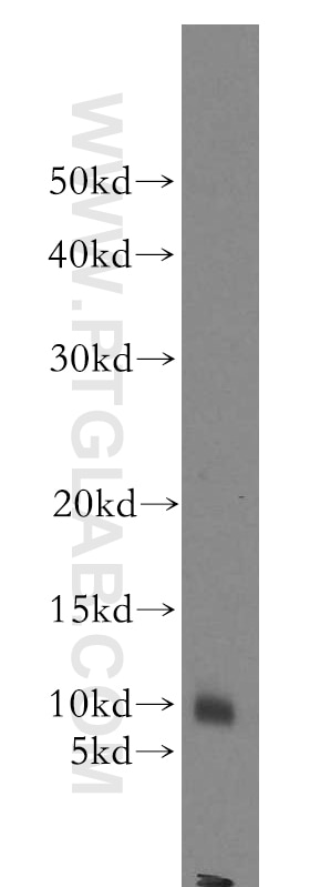 Western Blot (WB) analysis of mouse pancreas tissue using STATH Polyclonal antibody (19724-1-AP)