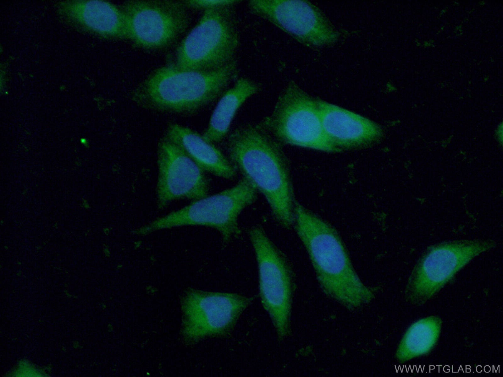 Immunofluorescence (IF) / fluorescent staining of HeLa cells using STAU1 Polyclonal antibody (14225-1-AP)