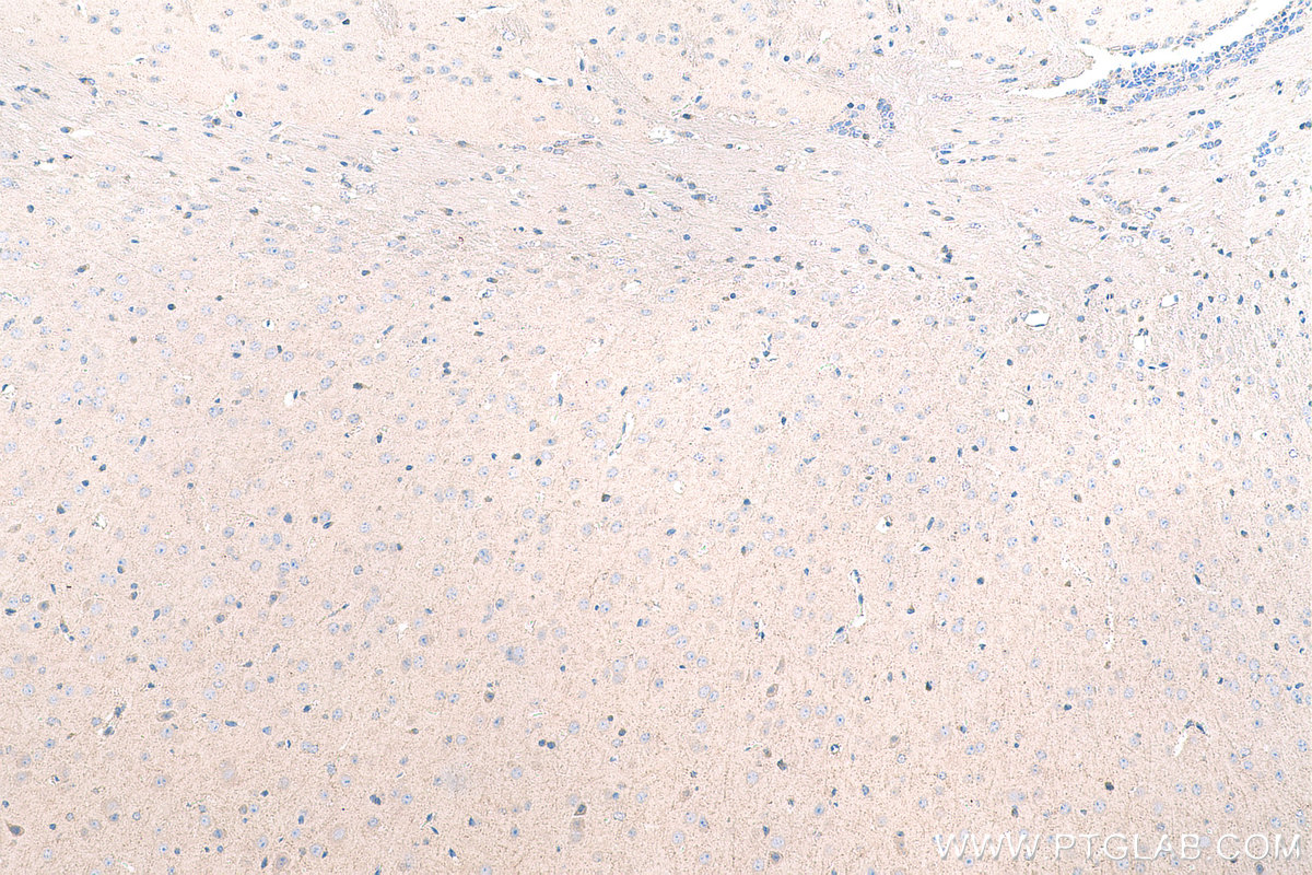 Immunohistochemistry (IHC) staining of mouse brain tissue using STAU1 Polyclonal antibody (14225-1-AP)