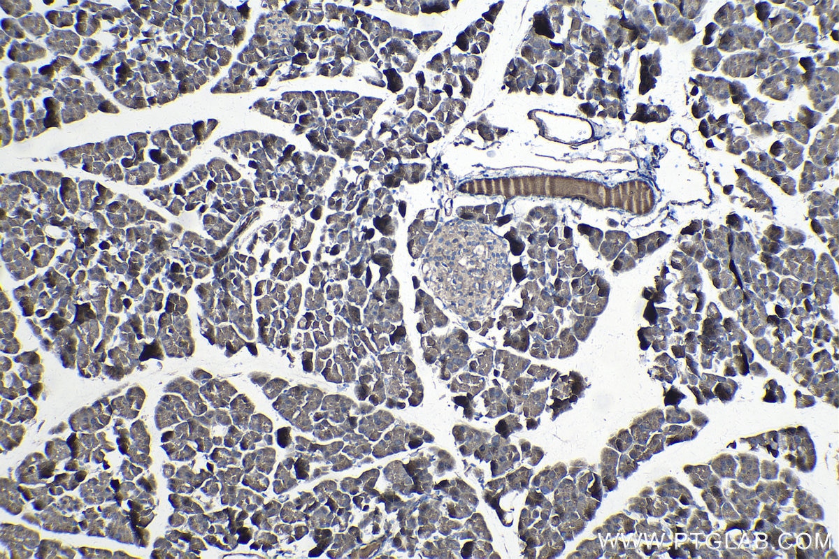 IHC staining of mouse pancreas using 14225-1-AP
