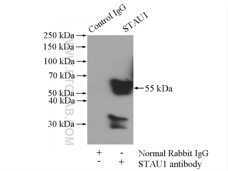 Immunoprecipitation (IP) experiment of mouse brain tissue using STAU1 Polyclonal antibody (14225-1-AP)