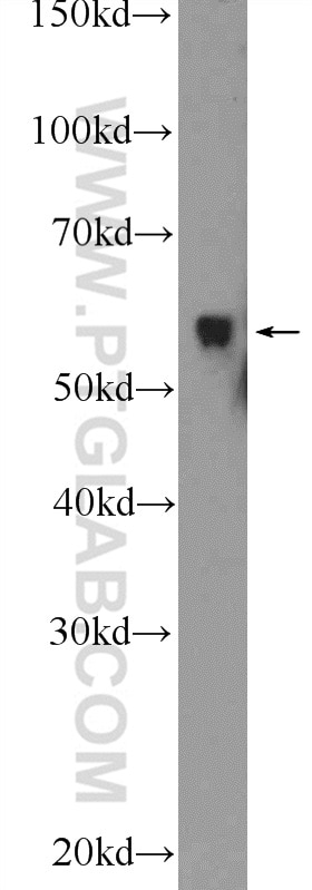 Western Blot (WB) analysis of mouse brain tissue using STAU1 Polyclonal antibody (14225-1-AP)