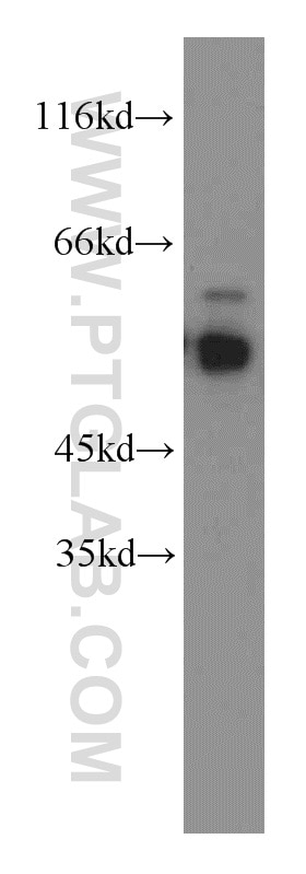 Western Blot (WB) analysis of K-562 cells using STAU1 Polyclonal antibody (14225-1-AP)