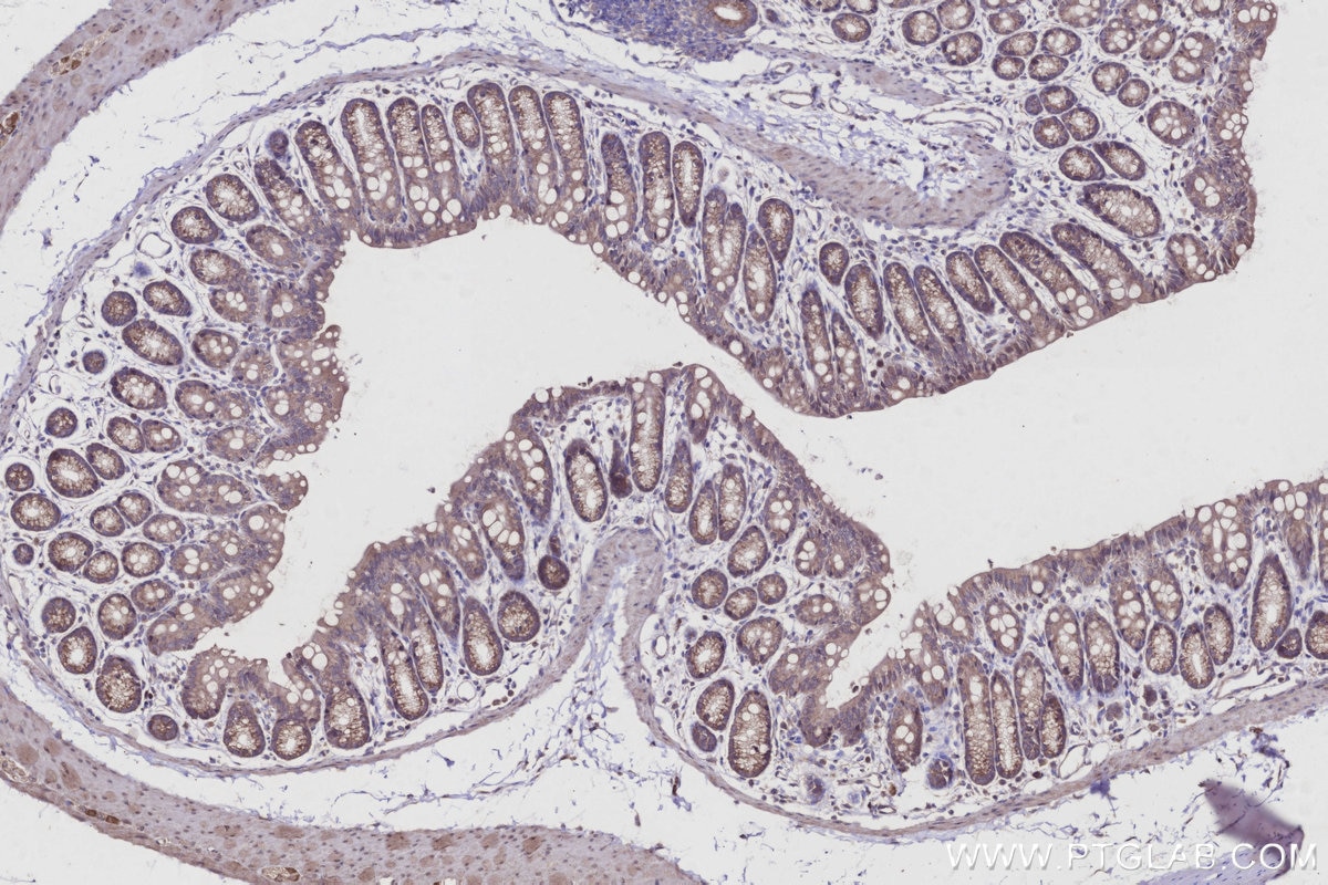 IHC staining of mouse colon using 15998-1-AP Immunohistochemistry (IHC) staining of mouse colon tissue using STAU2 Polyclonal antibody (15998-1-AP)