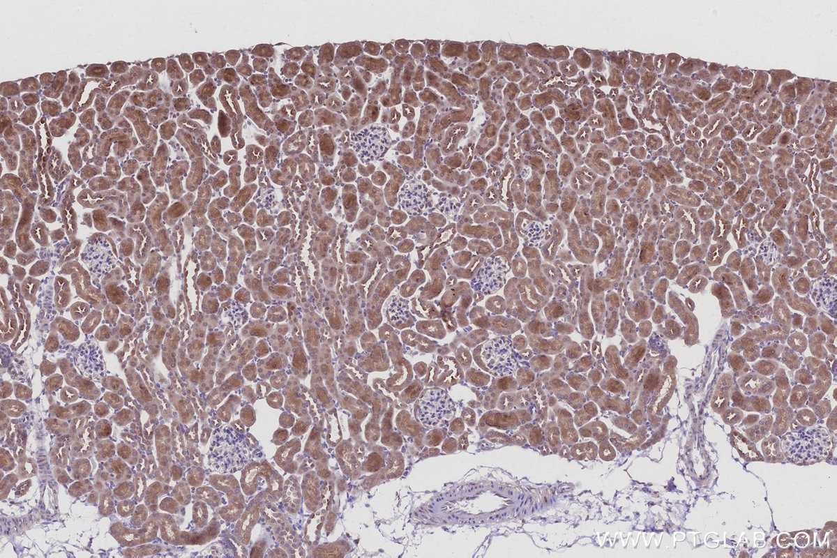 IHC staining of mouse kidney using 15998-1-AP Immunohistochemistry (IHC) staining of mouse kidney tissue using STAU2 Polyclonal antibody (15998-1-AP)