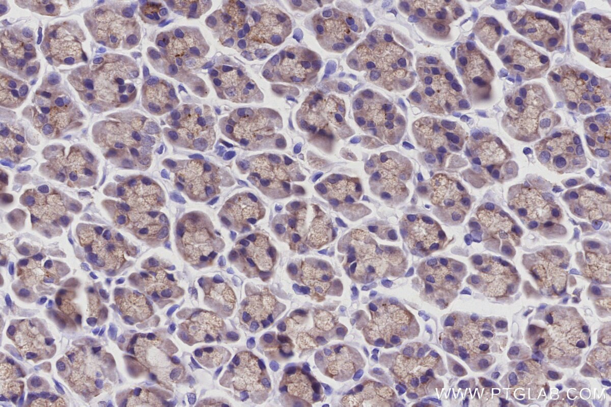 IHC staining of rat stomach using 15998-1-AP Immunohistochemistry (IHC) staining of rat stomach tissue using STAU2 Polyclonal antibody (15998-1-AP)