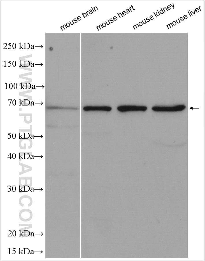 Western Blot (WB) analysis of various lysates using STAU2 Polyclonal antibody (15998-1-AP)