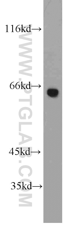 Western Blot (WB) analysis of mouse kidney tissue using STAU2 Polyclonal antibody (15998-1-AP)