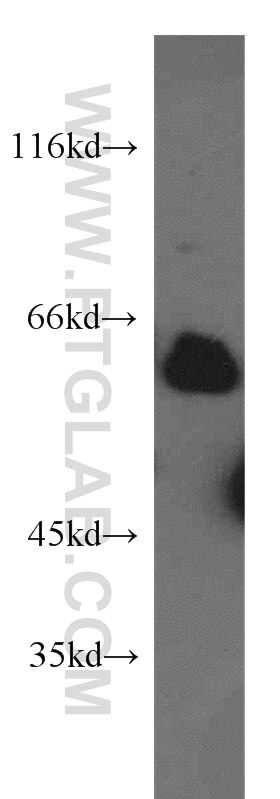 Western Blot (WB) analysis of mouse liver tissue using STAU2 Polyclonal antibody (15998-1-AP)