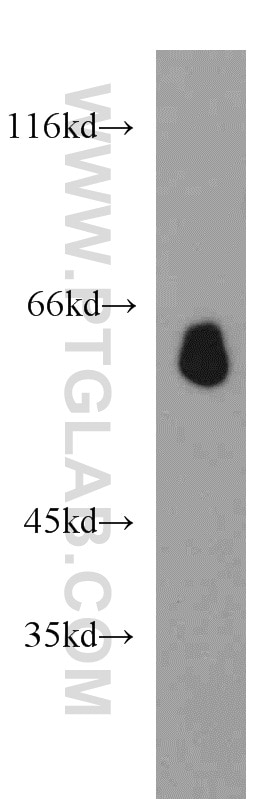 Western Blot (WB) analysis of mouse heart tissue using STAU2 Polyclonal antibody (15998-1-AP)