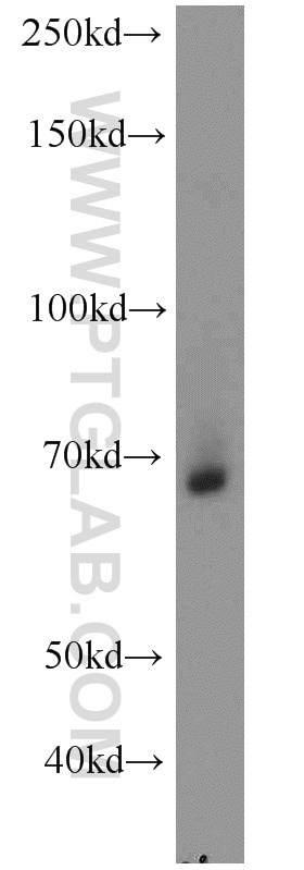 Western Blot (WB) analysis of mouse heart tissue using STAU2 Polyclonal antibody (15998-1-AP)