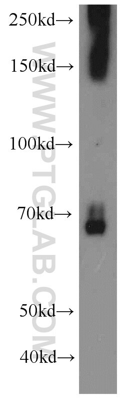 Western Blot (WB) analysis of mouse liver tissue using STAU2 Polyclonal antibody (15998-1-AP)
