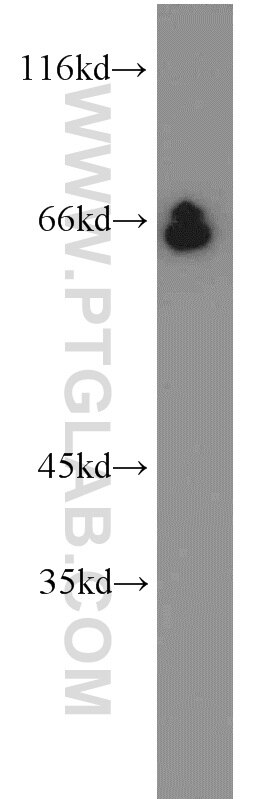 Western Blot (WB) analysis of mouse liver tissue using STAU2 Polyclonal antibody (15998-1-AP)