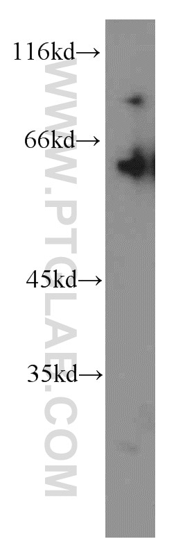 Western Blot (WB) analysis of mouse kidney tissue using STAU2 Polyclonal antibody (15998-1-AP)