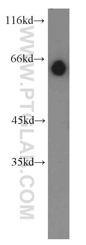 Western Blot (WB) analysis of mouse kidney tissue using STAU2 Polyclonal antibody (15998-1-AP)
