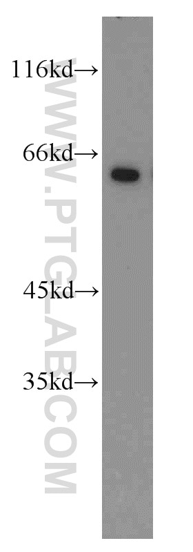 Western Blot (WB) analysis of mouse heart tissue using STAU2 Polyclonal antibody (15998-1-AP)