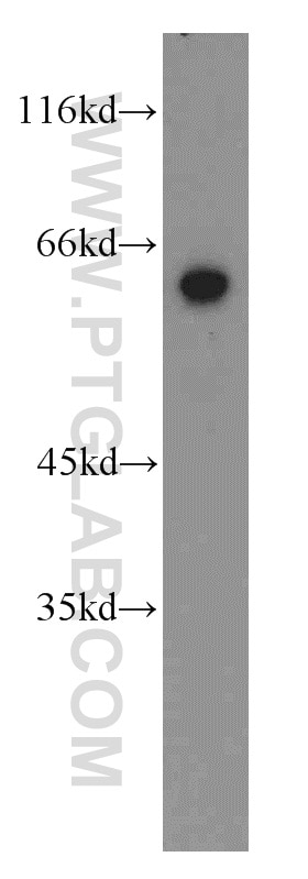 Western Blot (WB) analysis of mouse heart tissue using STAU2 Polyclonal antibody (15998-1-AP)