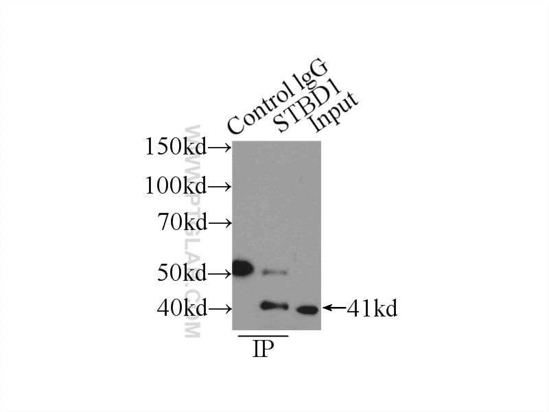 Immunoprecipitation (IP) experiment of A549 cells using STBD1 Polyclonal antibody (11842-1-AP)