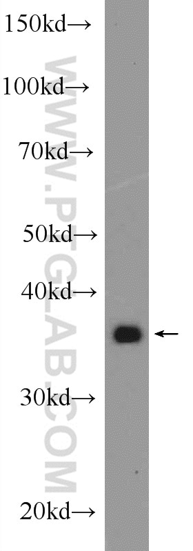 Western Blot (WB) analysis of A549 cells using STBD1 Polyclonal antibody (11842-1-AP)