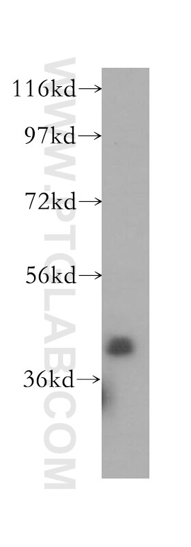 Western Blot (WB) analysis of HeLa cells using STBD1 Polyclonal antibody (11842-1-AP)