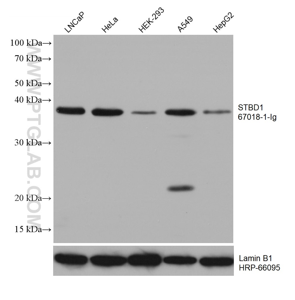 Western Blot (WB) analysis of various lysates using STBD1 Monoclonal antibody (67018-1-Ig)