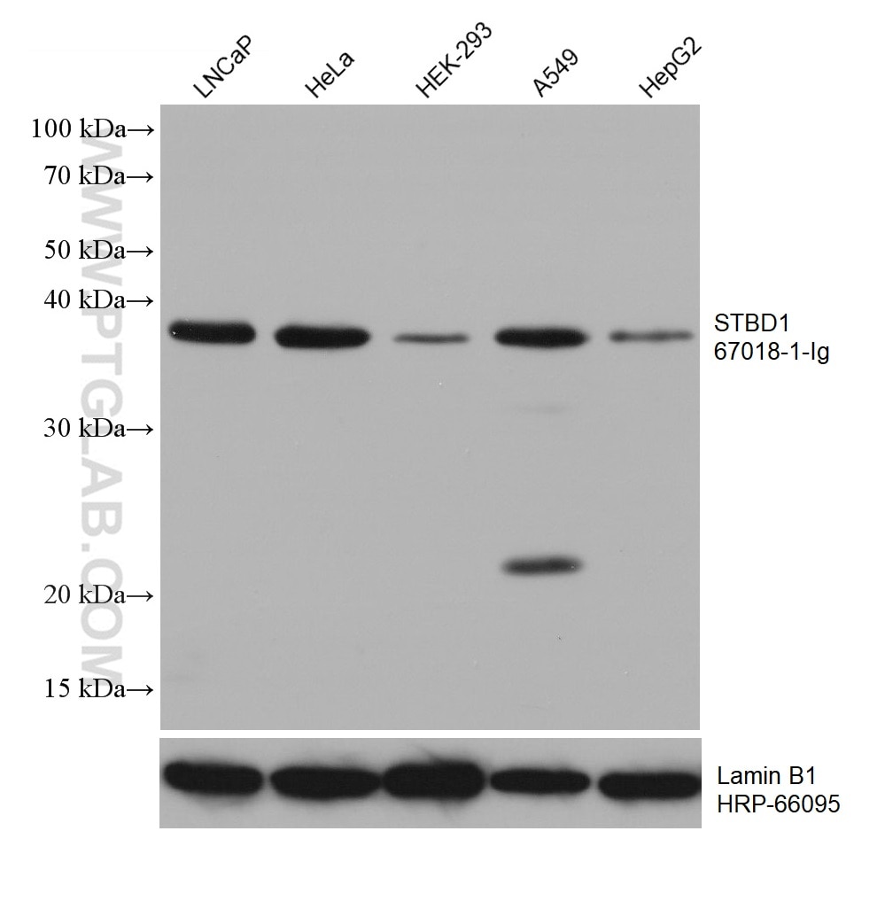 WB analysis using 67018-1-Ig