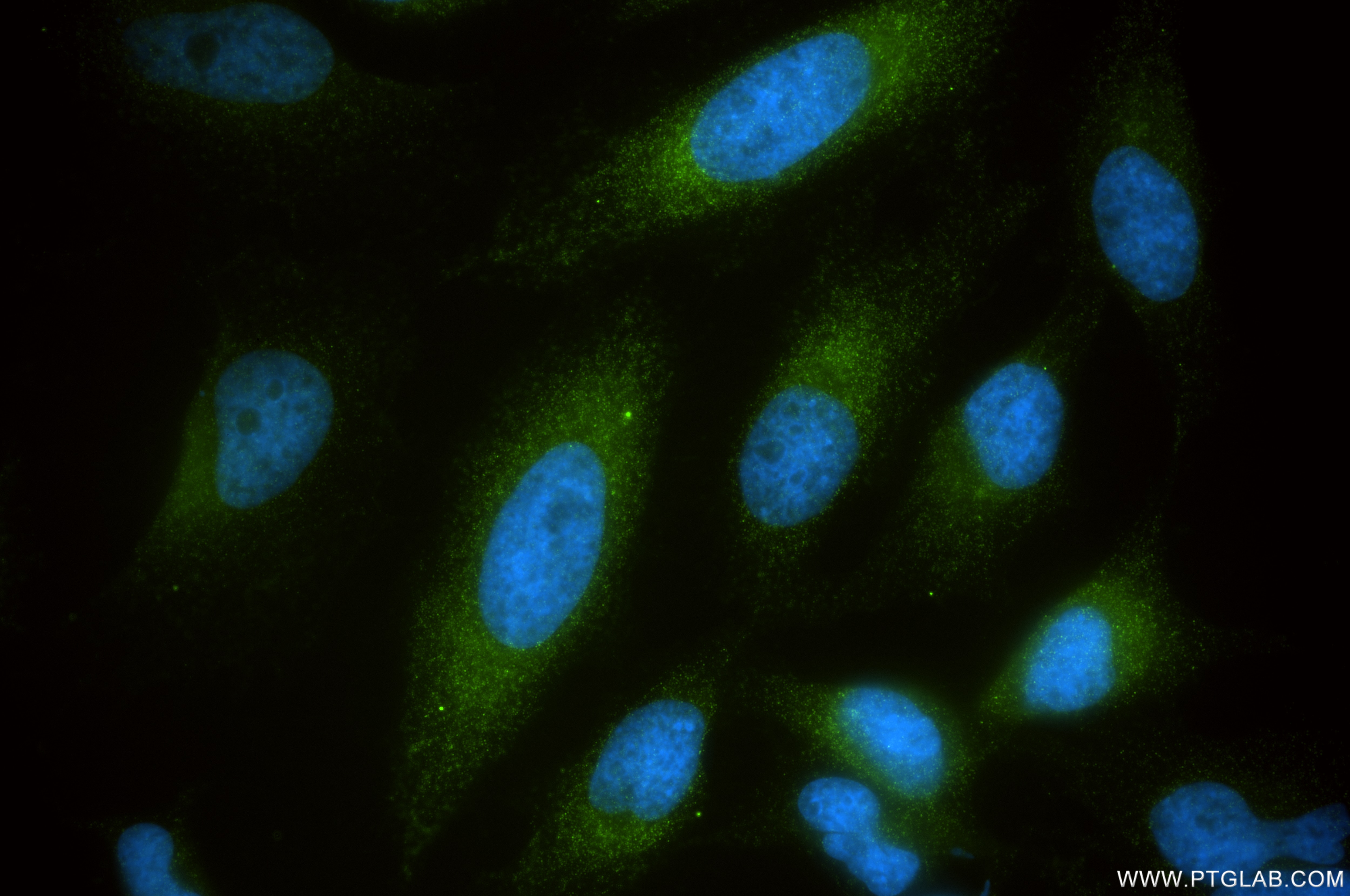 Immunofluorescence (IF) / fluorescent staining of HeLa cells using STBD1 Recombinant monoclonal antibody (87526-1-RR)