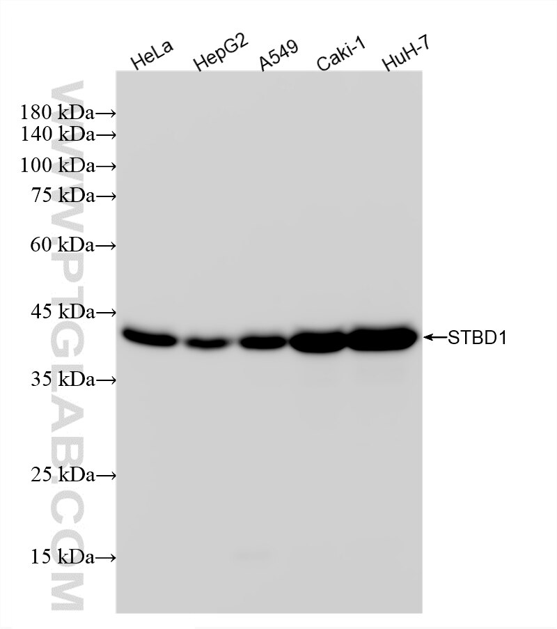 Western Blot (WB) analysis of various lysates using STBD1 Recombinant monoclonal antibody (87526-1-RR)