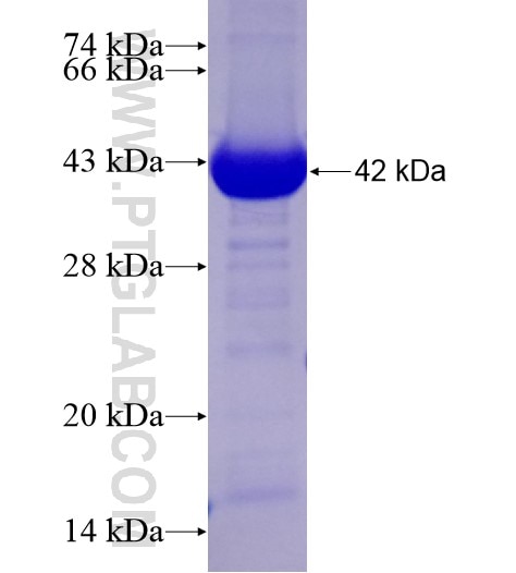 STBD1 fusion protein Ag28613 SDS-PAGE