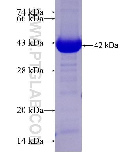 STBD1 fusion protein Ag28613 SDS-PAGE