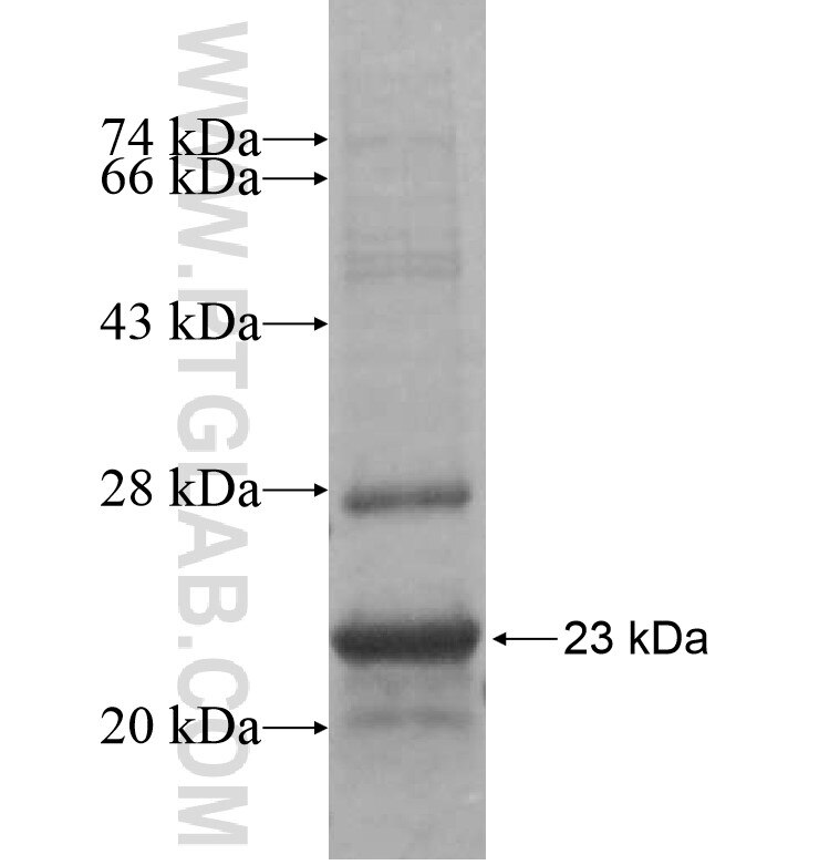 STC1 fusion protein Ag16277 SDS-PAGE