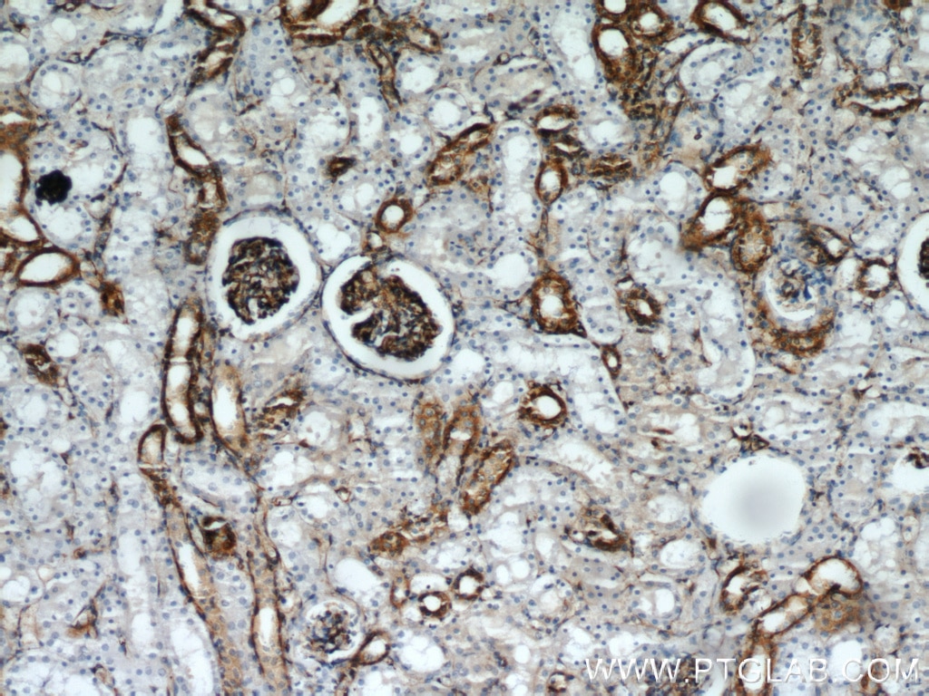 Immunohistochemistry (IHC) staining of human kidney tissue using Stanniocalcin 2 Polyclonal antibody (10314-1-AP)