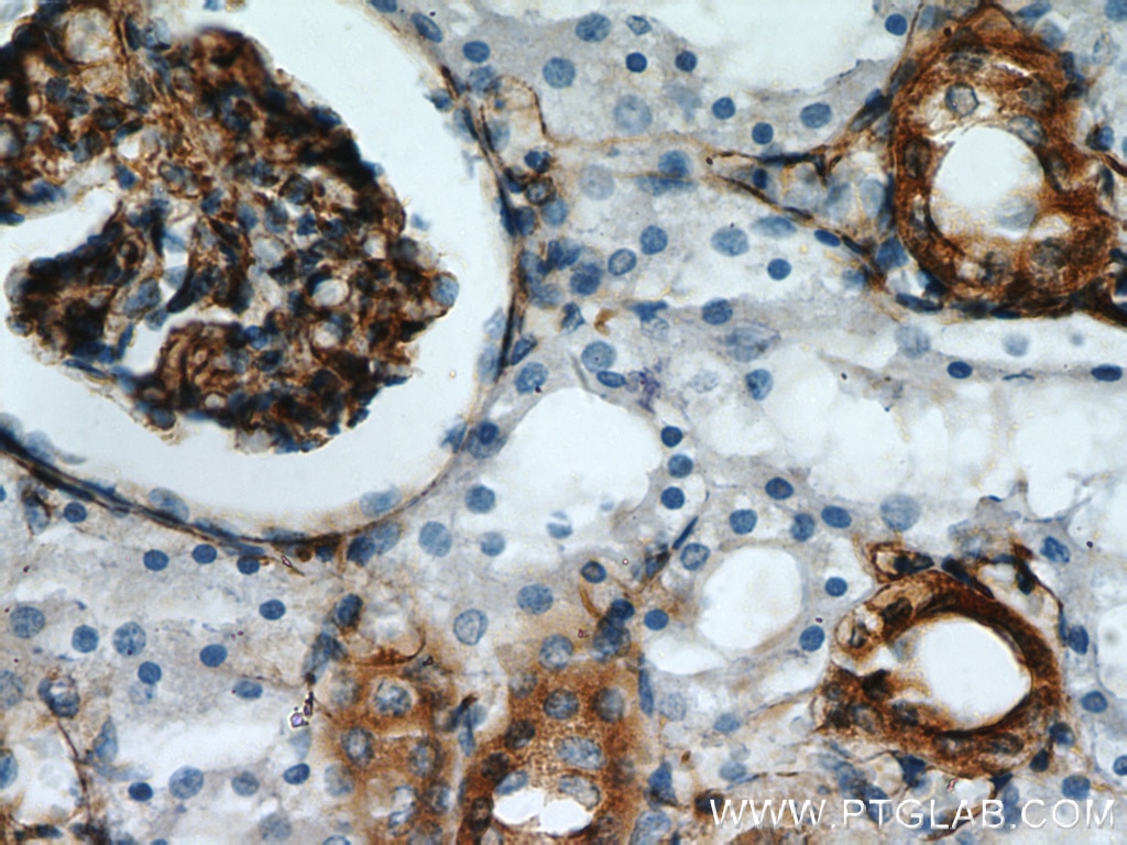 Immunohistochemistry (IHC) staining of human kidney tissue using Stanniocalcin 2 Polyclonal antibody (10314-1-AP)