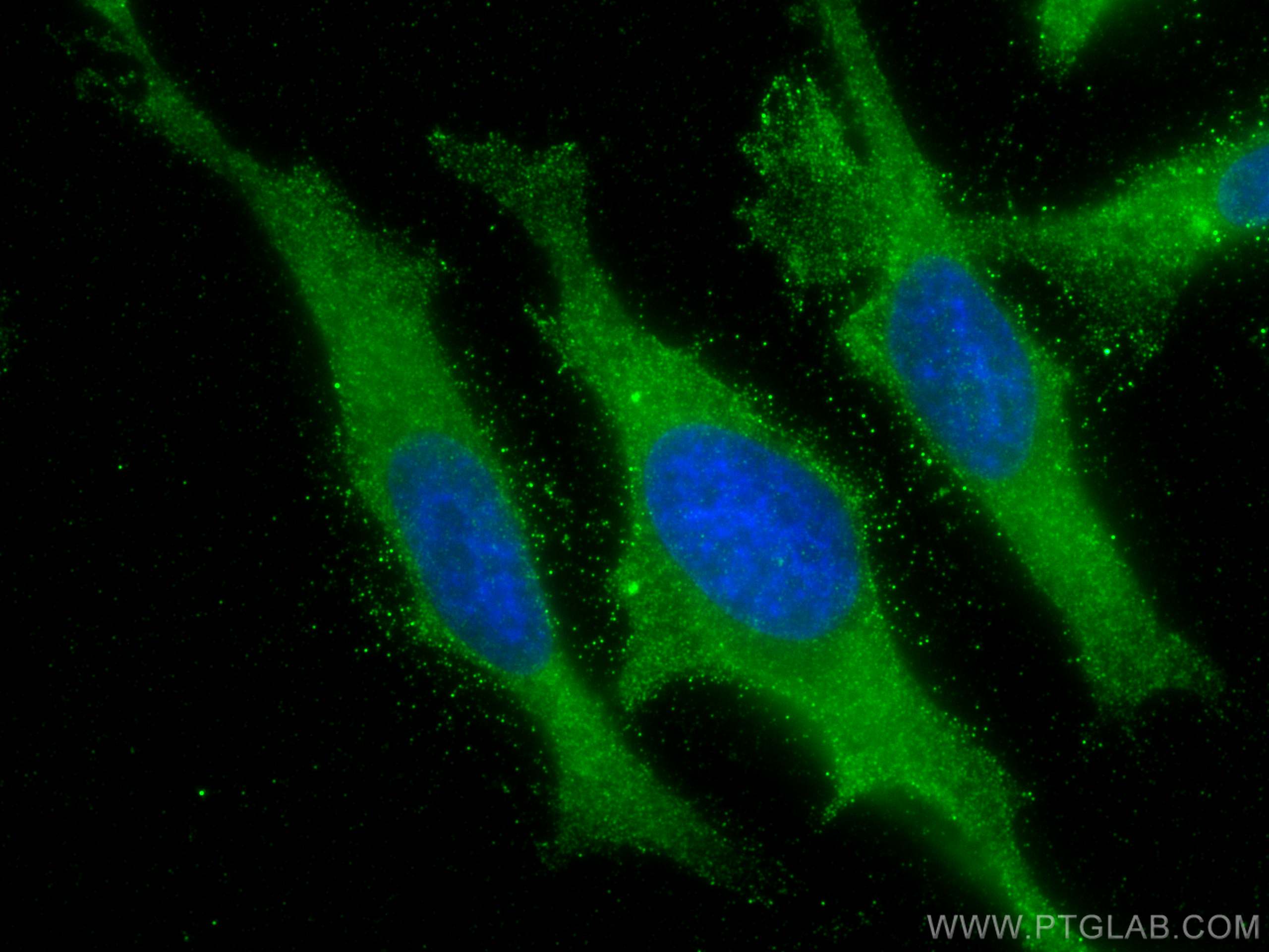 Immunofluorescence (IF) / fluorescent staining of HeLa cells using Stanniocalcin 2 Monoclonal antibody (60063-1-Ig)