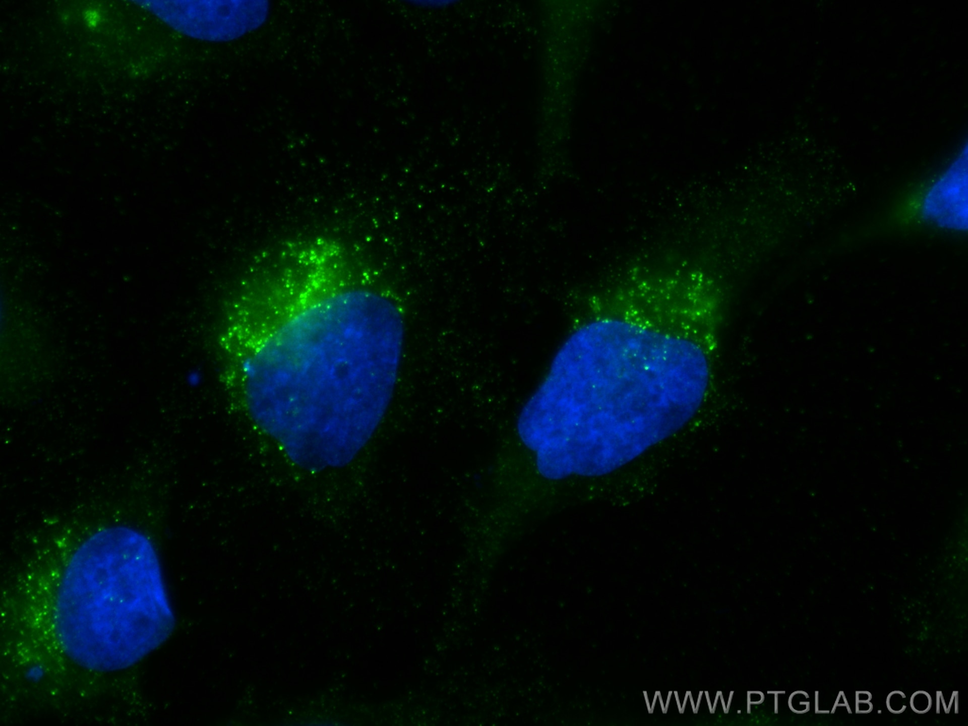 Immunofluorescence (IF) / fluorescent staining of HeLa cells using Stanniocalcin 2 Monoclonal antibody (60063-1-Ig)