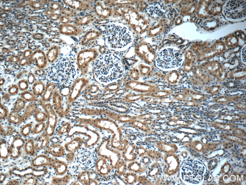 Immunohistochemistry (IHC) staining of human kidney tissue using Stanniocalcin 2 Monoclonal antibody (60063-1-Ig)