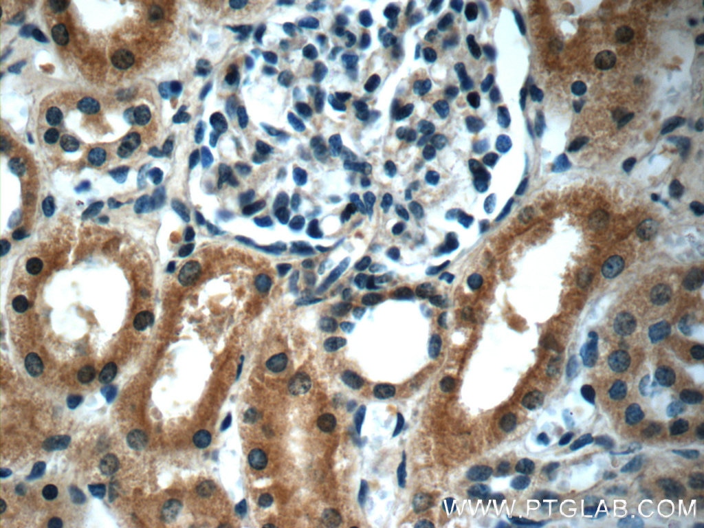 IHC staining of human kidney using 60063-1-Ig