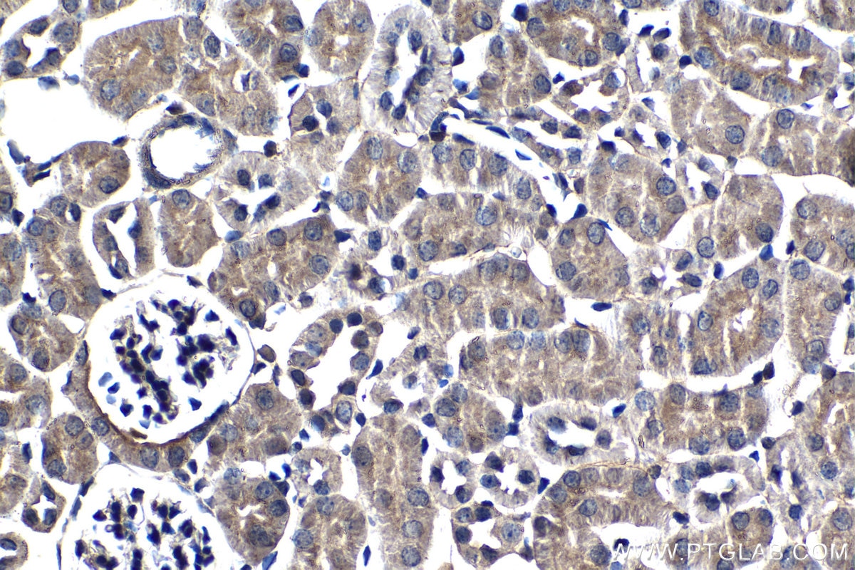 Immunohistochemistry (IHC) staining of mouse kidney tissue using Stanniocalcin 2 Monoclonal antibody (60063-1-Ig)