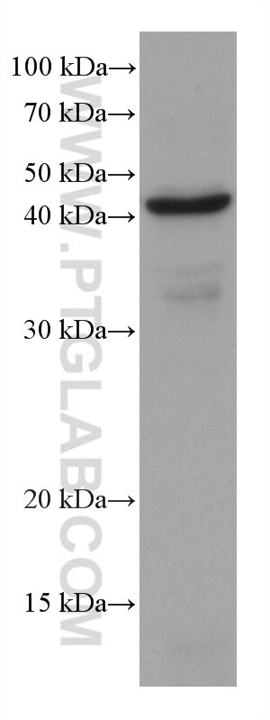 WB analysis of PC-3 using 60063-1-Ig