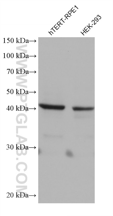 Western Blot (WB) analysis of various lysates using Stanniocalcin 2 Monoclonal antibody (60063-1-Ig)