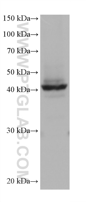 WB analysis of T-47D using 60063-1-Ig