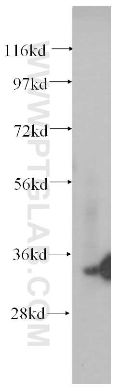 Western Blot (WB) analysis of HEK-293 cells using Stanniocalcin 2 Monoclonal antibody (60063-1-Ig)